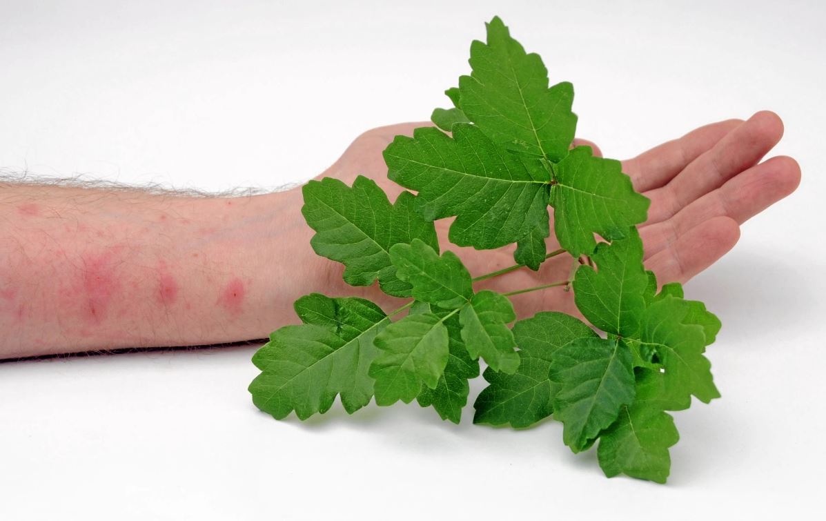 Avoiding And Dealing With The Misery Of Poison Oak